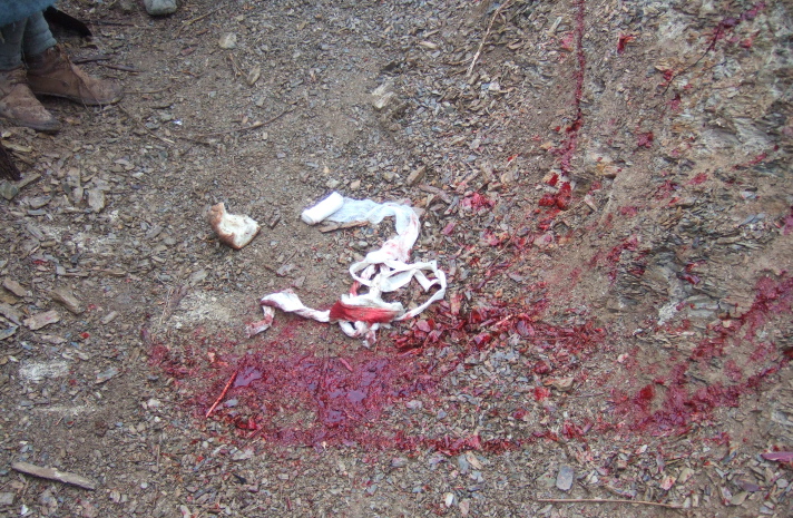 Bloody bandages remain in the trench in the wake of an attack, April 2008.