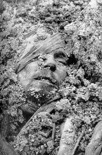 A wounded French soldier killed and mostly buried by a shell blast. Verdun 1916.