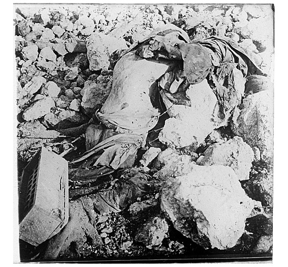 A headless, limbless torso at Verdun, 1916.