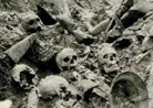 French soldier sits among the remains of German soldiers piled up in the Death Ravine at Verdun.