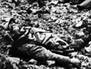 Dead French soldier missing legs, Verdun.